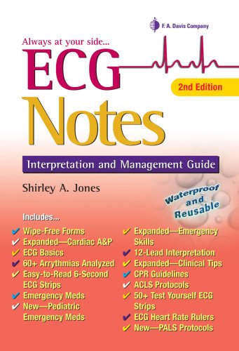 ECG Notes: Interpretation and Management Guide