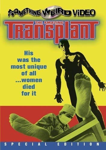 The Amazing Transplant
