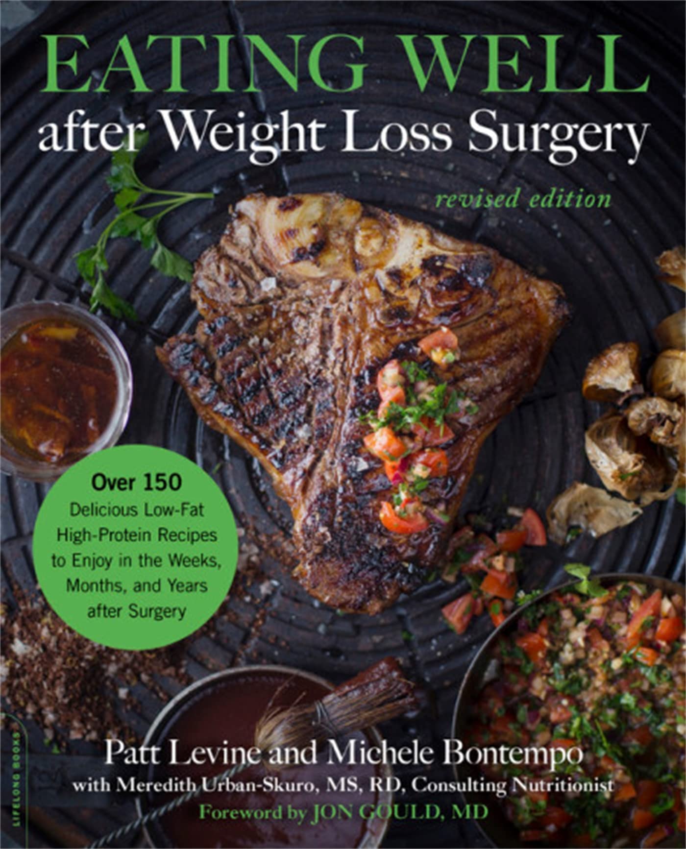 Eating Well after Weight Loss Surgery: Over 150 Delicious Low-Fat High-Protein Recipes to Enjoy in the Weeks, Months, and Years after Surgery