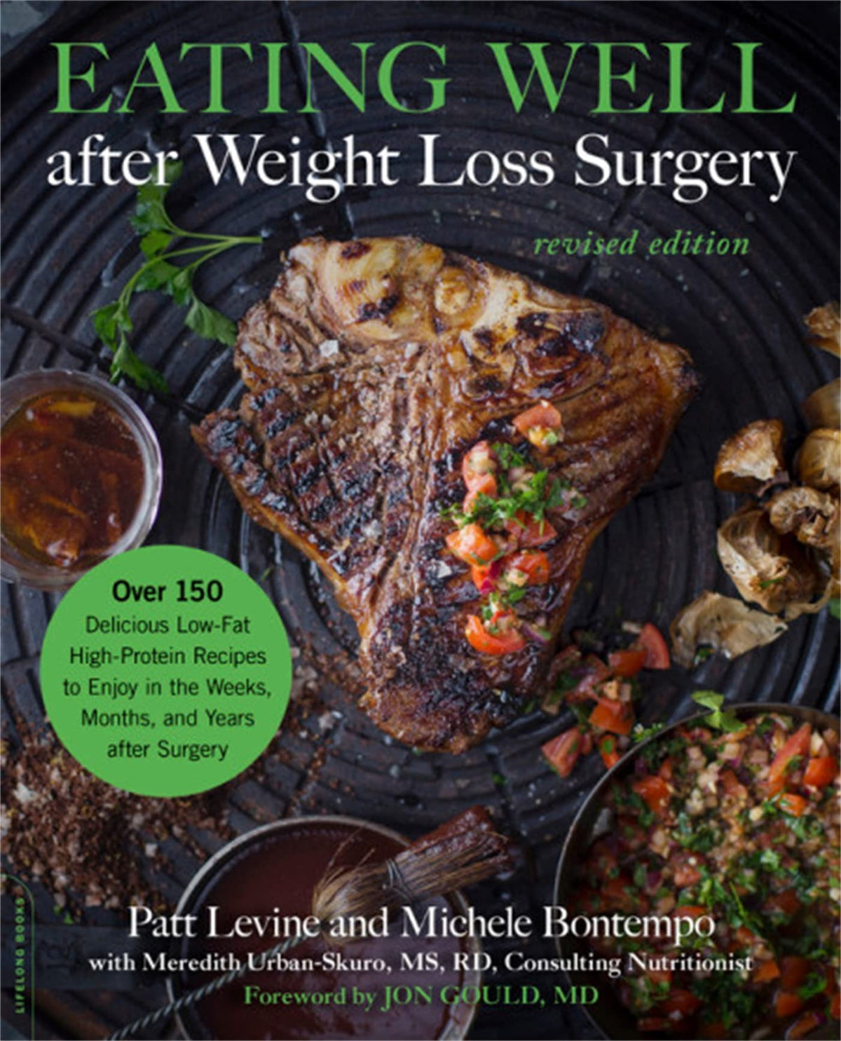 Eating Well after Weight Loss Surgery: Over 150 Delicious Low-Fat High-Protein Recipes to Enjoy in the Weeks, Months, and Years after Surgery
