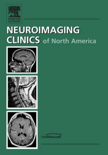 Advanced Pediatric Neuroimaging (Neuroimaging Clinics: Volume 16, Number 1, February 2006)