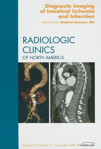 Diagnostic Imaging of the Intestinal Ischemia and Infarction, An Issue of Radiologic Clinics (Volume 46-5) (The Clinics: Radiology, Volume 46-5)