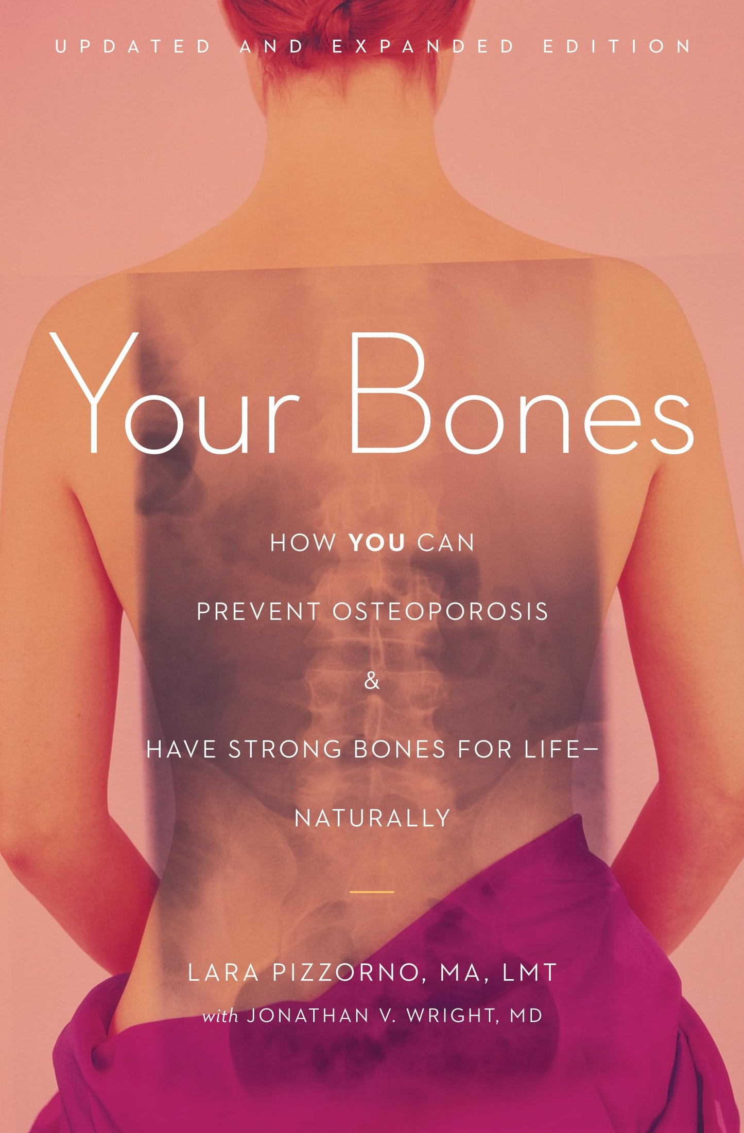 Your Bones: How You Can Prevent Osteoporosis and Have Strong Bones for Life―Naturally - 2203
